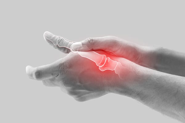 Arthritis and Inflammation Uncovered: Discover the Complex Connection and How to Manage It Effectively